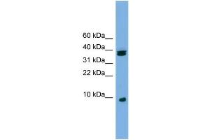 WB Suggested Anti-RPS21 Antibody Titration: 0. (RPS21 抗体  (Middle Region))