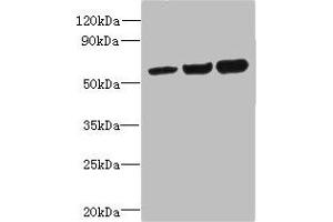 Western blot All lanes: OSBPL2 antibody at 1 μg/mL Lane 1: HepG2 whole cell lysate Lane 2: Mouse heart tissue Lane 3: Hela whole cell lysate Secondary Goat polyclonal to rabbit IgG at 1/10000 dilution Predicted band size: 56, 54 kDa Observed band size: 56 kDa (OSBPL2 抗体  (AA 251-480))