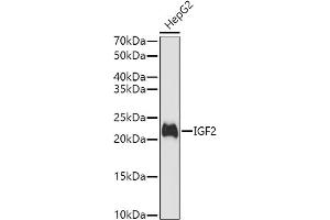 Western blot analysis of extracts of HepG2 cells, using IGF2 antibody (ABIN3022872, ABIN3022873, ABIN3022874 and ABIN6219274) at 1:1000 dilution. (IGF2 抗体  (AA 25-180))