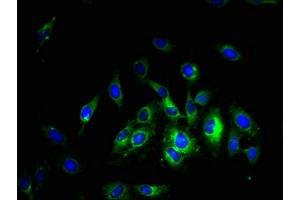 Immunofluorescent analysis of Hela cells using ABIN7169968 at dilution of 1:100 and Alexa Fluor 488-congugated AffiniPure Goat Anti-Rabbit IgG(H+L) (Slc38a5 抗体  (AA 1-48))