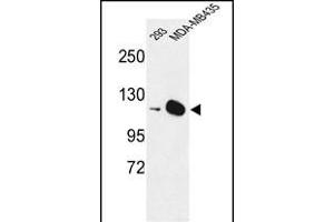 Western blot analysis of DIH2 Antibody (Center) 9407c in 293, MDA-M cell line lysates (35 μg/lane). (DIAPH2 抗体  (AA 870-899))