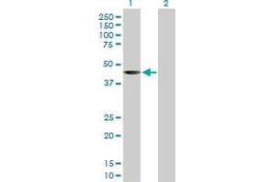Western Blot analysis of SGK2 expression in transfected 293T cell line by SGK2 MaxPab rabbit polyclonal antibody. (SGK2 抗体  (AA 1-367))