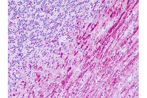 Human, Brain, Cerebellum: Formalin-Fixed Paraffin-Embedded (FFPE) (Serotonin Receptor 6 抗体  (C-Term))
