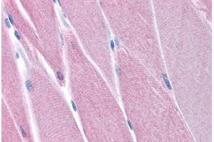 Human Skeletal Muscle (formalin-fixed, paraffin-embedded) stained with PDK4 antibody ABIN214801 at 5 ug/ml followed by biotinylated goat anti-rabbit IgG secondary antibody ABIN481713, alkaline phosphatase-streptavidin and chromogen. (PDK4 抗体  (N-Term))