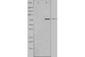 Western blot analysis of extracts from HeLa cells, using CEP78 antibody. (CEP78 抗体  (Internal Region))