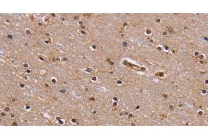 Immunohistochemistry of paraffin-embedded Human brain using GNL3 Polyclonal Antibody at dilution of 1:60 (Nucleostemin 抗体)