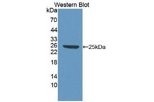 Detection of Recombinant HMG1, Human using Monoclonal Antibody to High Mobility Group Protein 1 (HMGB1) (HMGB1 抗体  (AA 1-215))