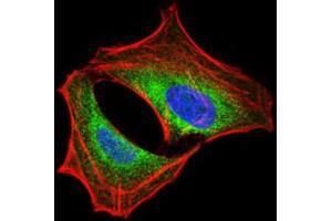 Immunohistochemistry (IHC) image for anti-Phosphoinositide 3 Kinase, p85 alpha (PI3K p85a) (AA 159-388) antibody (ABIN1844692)