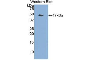 Western Blotting (WB) image for anti-Phospholipase A2, Group IIA (Platelets, Synovial Fluid) (PLA2G2A) (AA 22-146) antibody (ABIN1860250) (PLA2G2A 抗体  (AA 22-146))
