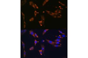 Immunofluorescence analysis of NIH-3T3 cells using ACLY Rabbit mAb (ABIN1678575, ABIN7101559, ABIN7101560 and ABIN7101561) at dilution of 1:100 (40x lens). (ACLY 抗体)