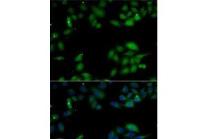 Immunofluorescence analysis of MCF7 cells using HIP1 Polyclonal Antibody (HIP1 抗体)