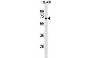 RLIM Antibody (Center) (ABIN1881751 and ABIN2838946) western blot analysis in HL-60 cell line lysates (35 μg/lane). (RLIM 抗体  (AA 199-227))