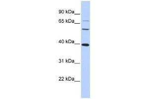 MAF antibody used at 1. (MAF 抗体  (N-Term))