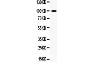 Anti- RANK Picoband antibody, Western blotting All lanes: Anti RANK  at 0. (TNFRSF11A 抗体  (AA 35-214))