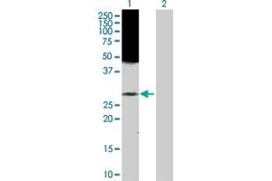 Western Blot analysis of RAB43 expression in transfected 293T cell line by RAB43 MaxPab polyclonal antibody. (RAB43 抗体  (AA 1-212))