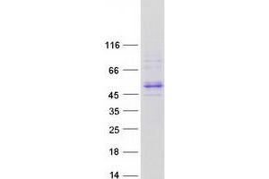 Western Blotting (WB) image for Allantoicase (ALLC) (Transcript Variant 1) protein (Myc-DYKDDDDK Tag) (ABIN2714582)