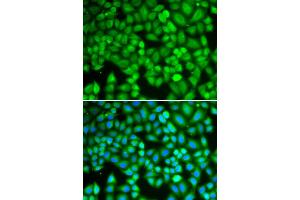 Immunofluorescence analysis of U2OS cell using WAS antibody. (WASP 抗体)