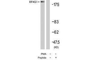 Western blot analysis of extract from 293 cells, using EIF4G1 polyclonal antibody . (EIF4G1 抗体  (Ser1232))