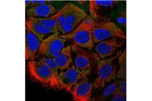 Immunofluorescence: This antibody stained CACO-2 cells. (CCL28 抗体)