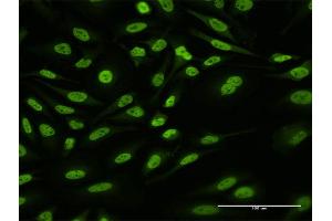 Immunofluorescence of purified MaxPab antibody to HNRNPUL1 on HeLa cell.