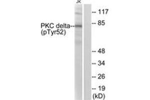 Western blot analysis of extracts from Jurkat cells treated with starved 24h, using PKC delta (Phospho-Tyr52) Antibody. (PKC delta 抗体  (pTyr52))