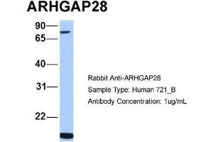 Human 721_B; Host:Rabbit. (ARHGAP28 抗体  (C-Term))
