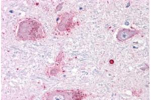 Anti-CHRM3 / M3 antibody  ABIN1048442 IHC staining of human brain, neurons and glia. (CHRM3 抗体  (C-Term))