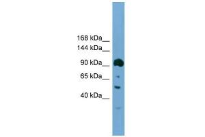 WB Suggested Anti-Ddx20 Antibody Titration:  0. (DDX20 抗体  (N-Term))
