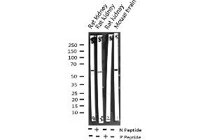 Western blot analysis of Phospho-MEF2A (Thr312) expression in various lysates (MEF2A 抗体  (pThr312))