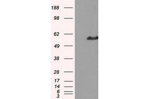 Western Blotting (WB) image for anti-Intraflagellar Transport 57 Homolog (IFT57) antibody (ABIN1498808) (IFT57 抗体)