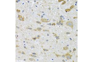 Immunohistochemistry of paraffin-embedded mouse spinal cord using CCT4 antibody (ABIN2561655) at dilution of 1:100 (40x lens). (CCT4 抗体)