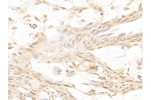 Immunohistochemistry (IHC) image for anti-Galectin 3 (LGALS3) (AA 1-250) antibody (ABIN7431560)