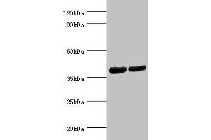Western blot All lanes: Renin receptor antibody at 2 μg/mL Lane 1: Hela whole cell lysate Lane 2: Mouse heart tissue Secondary Goat polyclonal to rabbit IgG at 1/10000 dilution Predicted band size: 40, 36 kDa Observed band size: 40 kDa (ATP6AP2 抗体  (AA 251-350))