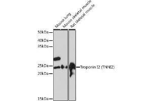 Western blot analysis of extracts of various cell lines, using Troponin I2 (Troponin I2 (TNNI2)) Rabbit mAb (ABIN1679777, ABIN7101727, ABIN7101728 and ABIN7101729) at 1:1000 dilution.