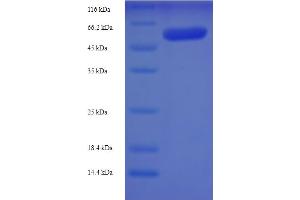 SDS-PAGE (SDS) image for Src Kinase Associated phosphoprotein 1 (SKAP1) (AA 1-358) protein (His-SUMO Tag) (ABIN5711475)