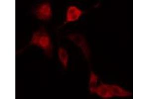 ABIN6277185 staining  Hela cells by IF/ICC. (IFIH1 抗体  (C-Term))