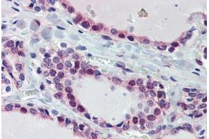 Thyroid, Human: Formalin-Fixed, Paraffin-Embedded (FFPE) (FUBP3 抗体  (AA 503-552))