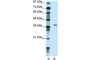 WB Suggested Anti-ZNF444 Antibody Titration:  2.