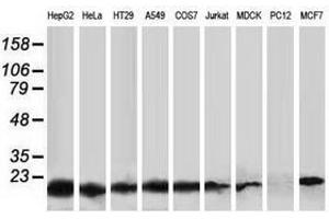 Image no. 3 for anti-Destrin (Actin Depolymerizing Factor) (DSTN) antibody (ABIN1497909) (Destrin 抗体)