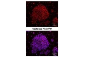 ICC/IF Image Immunofluorescence analysis of paraformaldehyde-fixed human embryonic stem cell, using SOX2, antibody at 1:100 dilution. (SOX2 抗体)