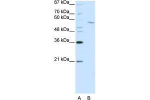 Western Blotting (WB) image for anti-REST Corepressor 1 (RCOR1) antibody (ABIN2461866) (CoREST 抗体)