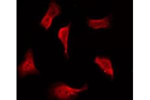 ABIN6276004 staining COLO205 by IF/ICC. (GPR114 抗体  (Internal Region))