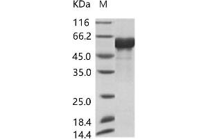 AcMNPV-GP64 protein (His tag)