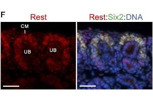 Co-immunostaining for anti-Rest (red) and Six2 (green) showing higher expression levels of Rest in Six2+ cap mesenchyme (CM) surrounding ureteric bud (UB). (REST 抗体  (AA 401-450))