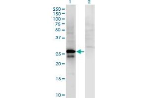 Western Blot analysis of SP2 expression in transfected 293T cell line by SP2 monoclonal antibody (M01), clone 5D3. (Sp2 抗体  (AA 71-161))
