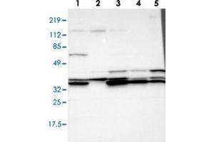 Western blot analysis of Lane 1: RT-4, Lane 2: U-251 MG, Lane 3: A-431, Lane 4: Liver, Lane 5: Tonsil with ADA polyclonal antibody  at 1:100-1:250 dilution. (ADA 抗体)