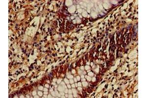 Immunohistochemistry (IHC) image for anti-Autophagy related 4B Cysteine Peptidase (ATG4B) (AA 350-400) antibody (ABIN7149021)