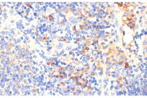 Immunohistochemistry of paraffin-embedded Mouse spleen using WNK3 Polyclonal Antibody at dilution of 1:100 (40x lens). (WNK3 抗体)
