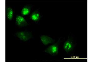 Immunofluorescence of monoclonal antibody to PHLDA1 on HeLa cell. (PHLDA1 抗体  (AA 1-109))