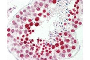 Anti-RBMXL2 antibody IHC staining of human testis. (RBMXL2 抗体  (AA 215-264))